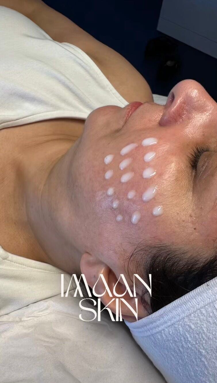 Serum applied to the skin during a microneedling session at Imaan Skin